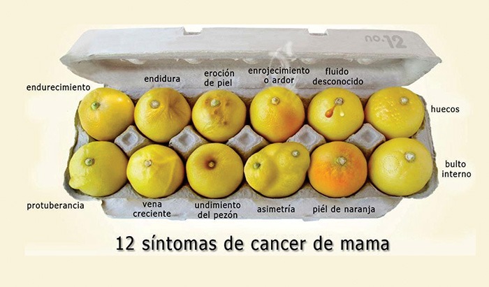 El Cáncer de Seno