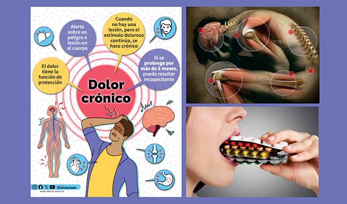 El Dolor Crónico